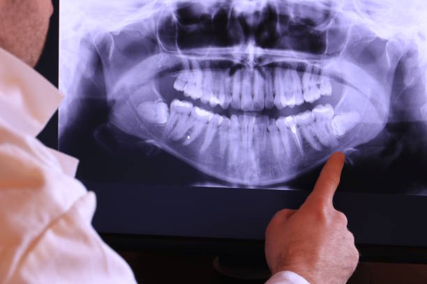 Best Emergency Tooth Extraction in Passapatanzy, VA