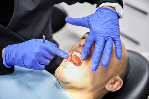 Best Emergency Tooth Extraction in Passapatanzy, VA