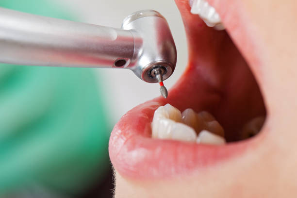Best Emergency Denture Repair in Passapatanzy, VA